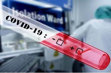 Usia Muda Lebih Berisiko Alami Infeksi Ulang Covid-19 