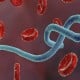 Kasus Ebola Muncul di Kongo dan Guinea, Afrika Diminta Waspada