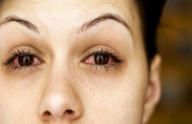 Riset : Covid-19 Bisa Sebabkan Masalah pada Mata