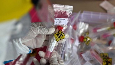 Epidemiolog : Jangan Gegabah Pakai Tes Antigen