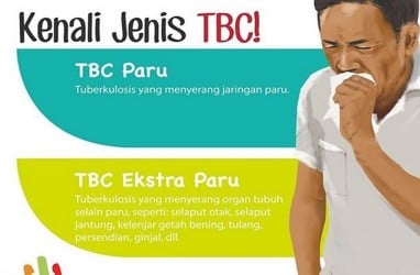 Waduh, Gara-Gara Covid-19 Penanganan Tuberkulosis Mundur 8 Tahun 