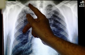 Penanganan Terganggu, Target Dunia Bebas TBC Bakal Meleset?