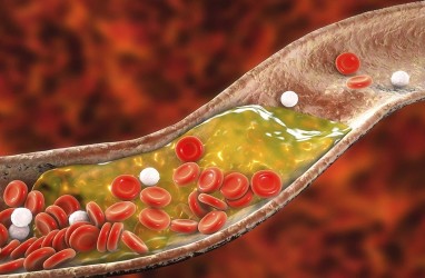 10 Cara Turunkan Kolesterol Secara Alami, Tanpa Obat