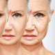 Studi L’Oréal : 75 Persen Penuaan dini Akibat Sinar UV