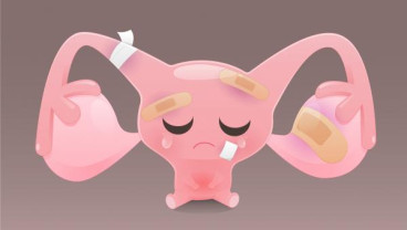 Cek Kesehatan Reproduksi Perempuan, Kenali Gejala Adenomiosis