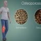 Dear Kaum Rebahan, Mager bisa Bikin Osteoporosis Lho