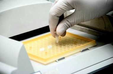 Begini Cara Deteksi Virus Corona yang Lolos Tes PCR Menurut Eijkman