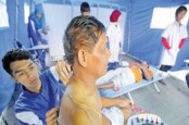 Manfaat Akupuntur, Mulai dari Pengobatan Kolesterol Hingga Stroke