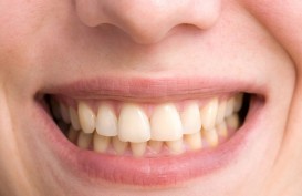 Penyebab Gigi Menjadi Kuning dan Cara Pencegahannya