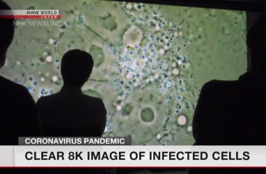 Kamera 8K Berhasil Tunjukkan Kondisi Sel yang Terinfeksi Virus Corona