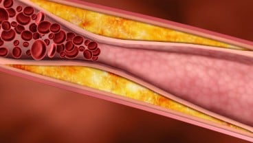   Riset Buktikan Sedikit Kasus Pembekuan Darah setelah Suntikan Vaksin AstraZeneca