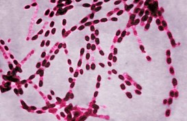 Virus Anthrax Picu Kematian 26 Sapi di Tulungagung