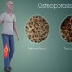 Hati-hati Kopi Lovers, Konsumsi Kafein Berlebihan Bisa Bikin Osteoporosis