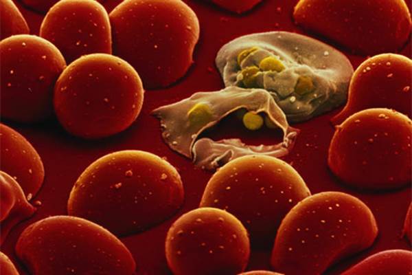 Parasit penyebab malaria/scitechdaily.com