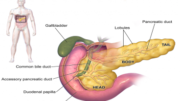 6 Tanda Kamu Mengalami Salah Satu Penyakit Paling Mematikan, Kanker Pankreas