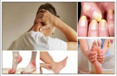 Tips Sehat, 10 Cara Menurunkan Kolesterol