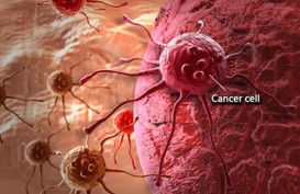 Perhatikan 7 Gejala Kanker yang Sering Kali Diabaikan