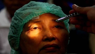 Waspadai 4 Masalah Mata yang Disebabkan Oleh Diabetes, Termasuk Kebutaan