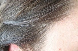 Rambut Beruban Sebelum Waktunya? Mungkin Anda Kekurangan Vitamin Ini