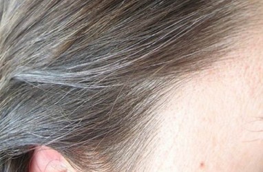 Rambut Beruban Sebelum Waktunya? Mungkin Anda Kekurangan Vitamin Ini