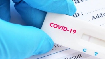 Ilmuwan Ungkap Minuman Ini Bisa Sebabkan Hasil Tes Positif Covid Palsu, Benarkah?