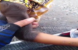 Viral Video Tangan Seorang Bocah Ditumbuhi Rambut Lebat