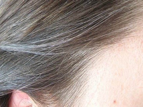 Rambut beruban/Istimewa