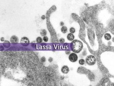 Muncul 2 Kasus Virus Lassa di Inggris, Apa Itu?