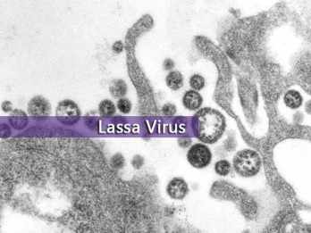 Muncul 2 Kasus Virus Lassa di Inggris, Apa Itu?