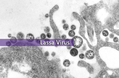 Muncul 2 Kasus Virus Lassa di Inggris, Apa Itu?