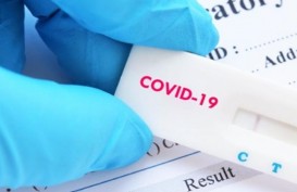 Cek Fakta : Tes Antigen Covid Tidak Akurat karena Hanya Mendeteksi Tingkat Antibodi