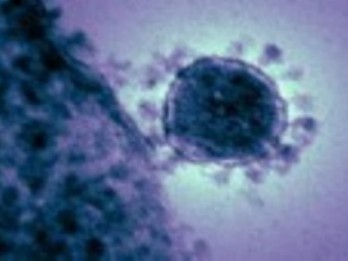 Sejarah Hari Ini, WHO Keluarkan Peringatan Pandemi SARS