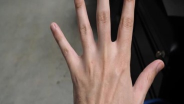 Ukuran Panjang Jari Menentukan Risiko Seseorang Terkena Covid