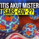 AS Coret SARS CoV 2 dari Daftar Virus Penyebab Hepatitis Akut Anak