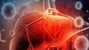 Benarkah Hepatitis Akut Misterius Berkaitan dengan Covid-19?