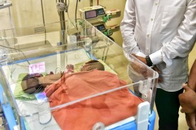 Bayi Kembar Siam Asal Sumut Diberi Nama Ririn dan…