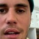 Justin Bieber Alami Kelumpuhan di Setengah Wajahnya, Konser Ditunda
