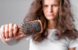 Cara Mengatasi dan Mencegah Rambut Rontok pada Perempuan dan Laki-laki
