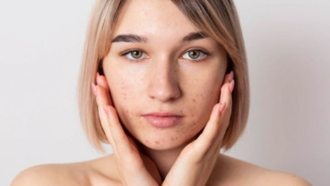 Mengenal Dermaplaning, Teknik Perawatan Kulit Agar Halus dan Lembut
