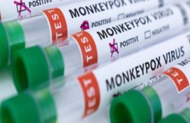 1 Suspek Monkeypox Terkonfirmasi di Jateng, Kemenkes: Bukan Gay