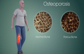 Makanan Mengandung Kalsium yang Bantu Cegah Osteoporosis