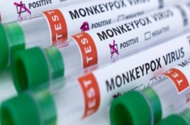 Ini Perbedaan Tes PCR pada Pasien Cacar Monyet dengan…