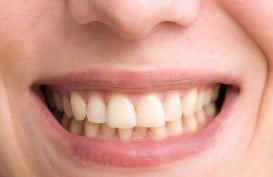 Cara Membersihkan Karang Gigi di Rumah, Mudah dan Murah