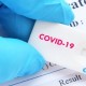 Dokter Patologi: Swab Antigen Bisa Minimalisir Penularan Covid-19