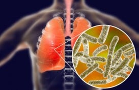Gejala Pneumonia Misterius, Penyakit yang Disebabkan Bakteri Legionnaires