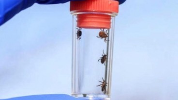 Cara Ampuh Menghilangkan Kutu Rambut yang Mengganggu
