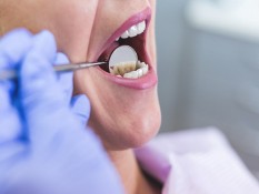 Ini 9 Penyakit Karena Sakit Gigi dan Iinfeksi Mulut