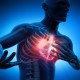 Ini Gejala, Penyebab dan Cara Mengatasi Serangan Jantung