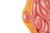 Fakta-fakta Seputar Hernia, Bisa Terjadi pada Bayi Baru Lahir
