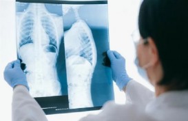 Sejumlah Dokter Radiologi Belum Terima STR meski Telah Ujian Kompetensi